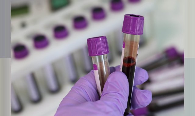 When was last time you had your blood work done? When was last time you had your blood work done?