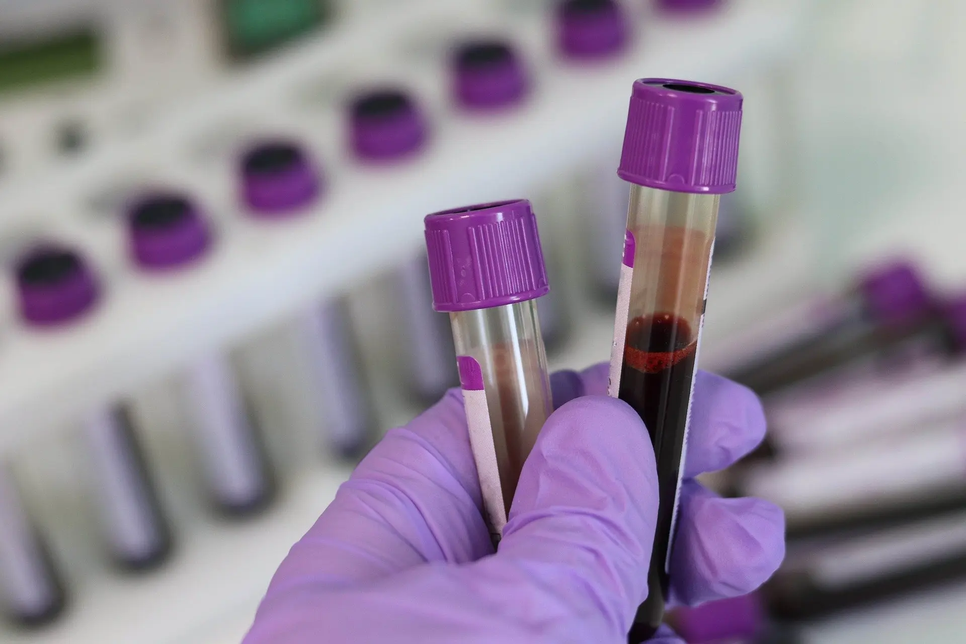 When was last time you had your blood work done?